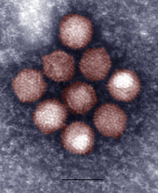 Image of adenovirus particle