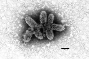Electron micrograph of rabies virus