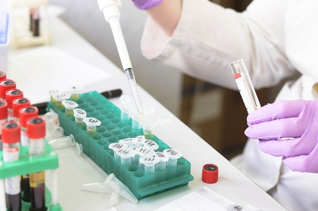 Image of a laboratory worker wearing purple gloves, using a pipette.