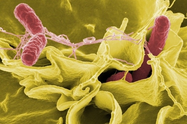 Image of a salmonella bacteria viewed through an electron microscope. The image appears in green and pink.