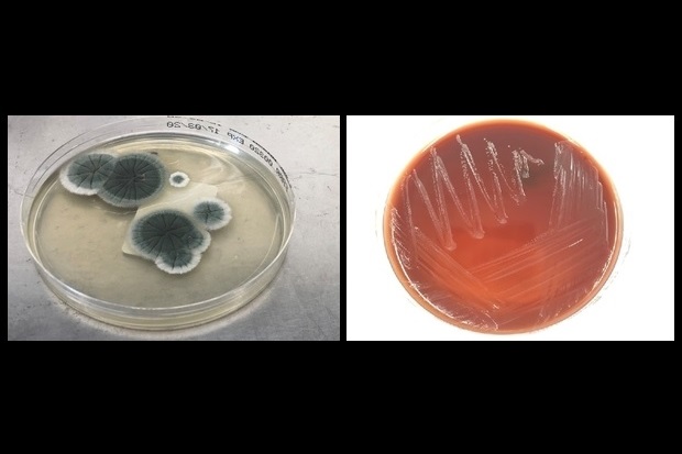 Image showing two agar plates. The one to the left contains two clusters of a dark grey culture. The one to the right shows streaks of white across a red culture medium.