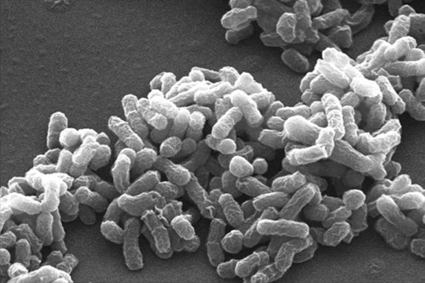 Electron micrograph image of Brucella bacteria in black and white