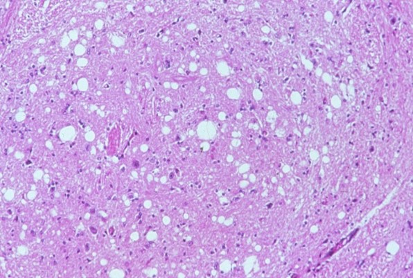 Pink image with white spots and darker pink areas