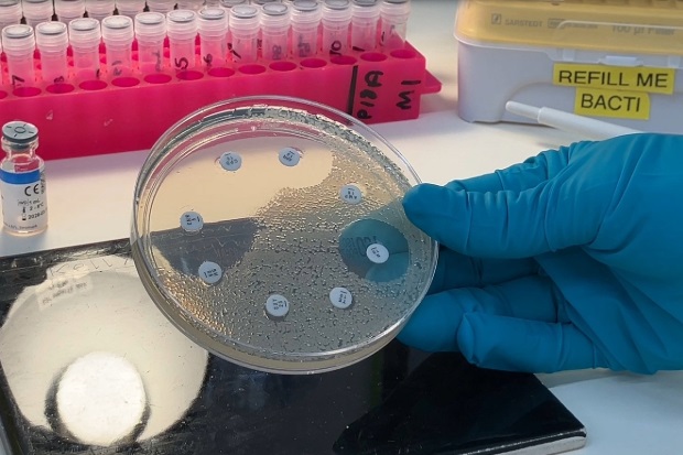 Gloved hand holding a small, circular clear dish with eight small white dots arranged across the surface. A white medium spreads across the dish which clusters around some of the dots and keeps clear of others.